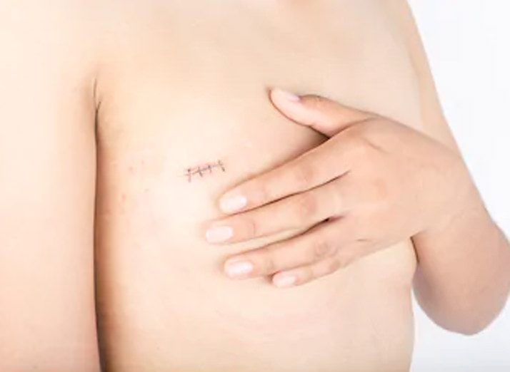 Lymphedema Reconstruction Honolulu, HI | Dr. Daniel Murariu