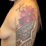 Breast Augmentation Before & After Patient #359